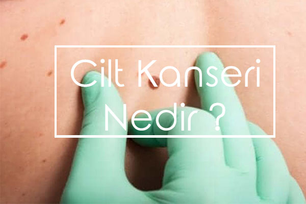 Cilt Kanseri Nedir?